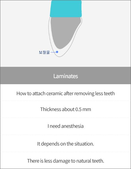 기존라미네이트
