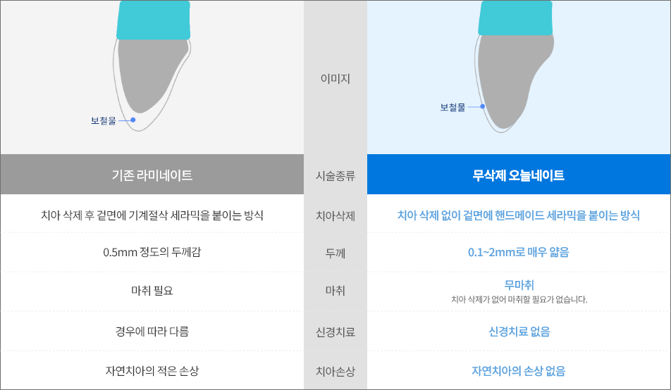 라미네이트 비교사진
